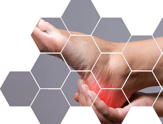 Болят ступни ног: расшифровка симптомов и эффективные решения